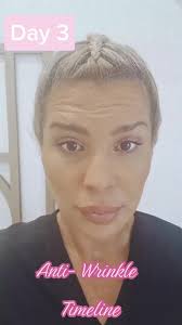 ANTI-WRINKLE TIMELINE , In...