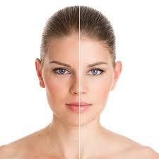 It mostly occurs due to an overproduction of melanin in the skin. Uneven Skin Tone Managing Uneven Skin Tone On Face Colorescience