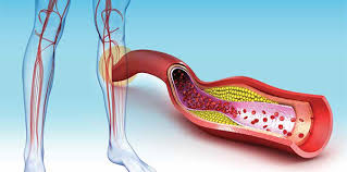 Specific treatment will be determined by your. Options Approaches To Outpatient Treatment Of Deep Vein Thrombosis For Emergency Physicians Acep Now