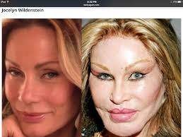 Pin By Mirian Rossin On Before After Bad Celebrity Plastic Surgery Plastic Surgery Celebrity Plastic Surgery