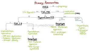 Agenesis of wisdom teeth is a normal condition that can differ widely by population, ranging from practically zero in tasmanian aborigines to nearly 100% in indigenous mexicans. Approach To Primary Amenorrhea Sketchy Medicine