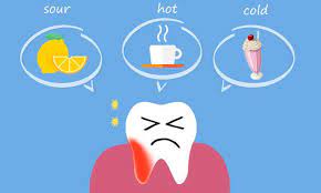 Did You Know Teeth Sensitivity Is Usually Caused Due To Exposed Dentine Discoverdental Oralhealth He Sensitive Teeth Remedy Teeth Implants Sensitive Teeth
