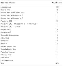 Die symptome können harmlos sein. Frontiers The Association Between Documentation Of Koplik Spots And Laboratory Diagnosis Of Measles And Other Rash Diseases In A National Measles Surveillance Program In Japan Microbiology