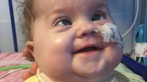 Scarlett's second chance: Brain damaged baby who survived against the odds  battles to come home