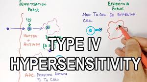 type iv hypersensitivity