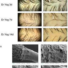 Image result for Trichoscypha silveirana