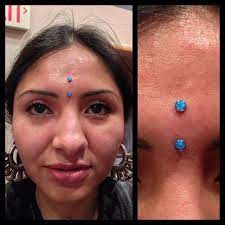 Fresh Vertical Bridge On Luz De Luna With Anatometal Flat Surface Bar With 4mm Blue Opals Piercing Piercings Ear Piercings Tragus