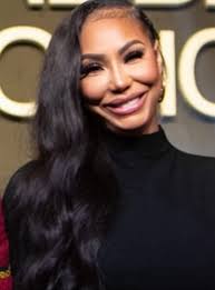 Tamar Braxton Injury Photos