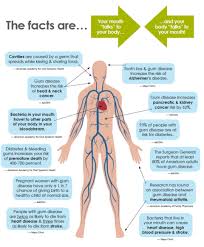 Gum Disease Periodontal Disease Smile Little Smiles And Smile Orthodontics