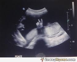 Mom Dad Peace Ultrasound Pictures Boy Ultrasound Funny Babies