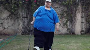 Axa seguros españa www.axa.es consulta las normas de uso de redes sociales de axa. Juan Pedro Franco El Hombre Mas Obeso Del Mundo Pierde 334 Kilos Y Vuelve A Caminar Sin Ayuda Tras 20 Anos Fotos Rpp Noticias