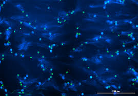 Ce terme vient de l'anglais netosis ou nets veut dire neutrophil extracellular traps. Quantifying Nets News Announcements Cayman Chemical