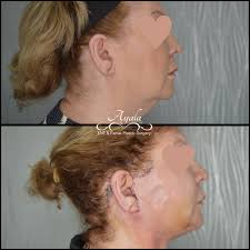 We sincerely appreciate Andrew Callan, MS3, from @utrgvsom for the  incredible dedication and effort you put into your rotation with us! Your  hard work and passion for medicine truly stood out. Wishing