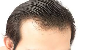 A wide variety of hairstyle thin hair options are available to you, such as hair extension type, virgin hair, and hair grade. Hairstyles For Older Men With Thinning Hair From Hair Mechanix