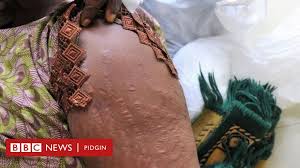 The reason it's so invasive is that the first step is to bleach your hair, and then to dye it using a hair dye that contains ammonia. Women Wey Dey Use Dangerous Skin Lightening Products Dey Risk Dia Health Bbc News Pidgin