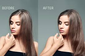 Less recovery time and fewer restrictions on activities after. Can Women Undergo Hair Transplant Surgery Proesthe Hair Transplant Eyebrow Transplant Aesthetic