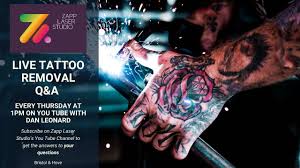 Successful multicoloured tattoo removal requires a high powered laser that can deliver enough. Picosure Laser Tattoo Removal Live Q A 8 Youtube