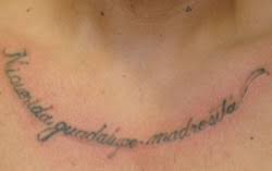 Since may i've now had 3 sessions and this time i saw the most color lift from. Why Did I Get Hives After Laser Tattoo Removal