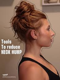 Effective Ways to Eliminate Neck Hump and Relieve Pain