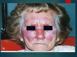 1 Copyright © 2014, 2011, 2006 by Saunders, an imprint of Elsevier, Inc.  Chapter 5 INFLAMMATION AND HEALING.