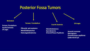 Pediatric Brain Tumors Dr Muhammad Bin Zulfiqar