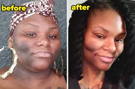 Shoutout To The Reviewers Who Remembered To Take “Before” Photos, Because  Now We Get To See How Effective These 32 Beauty Products Are
