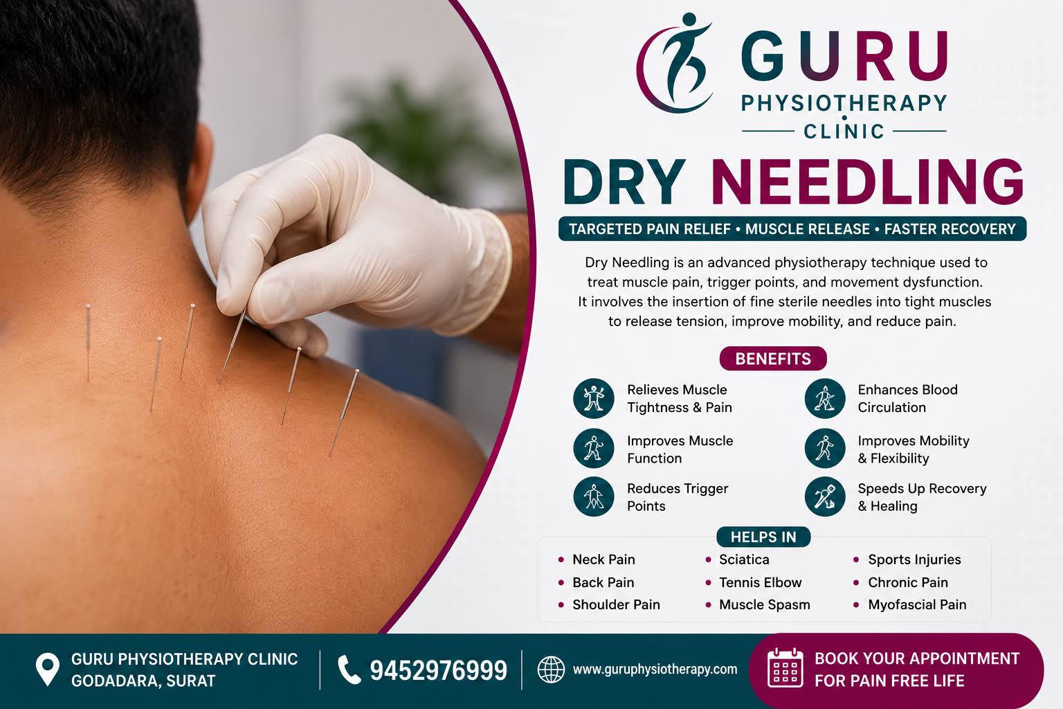 Dry Needling Therapy product image
