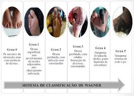The fewer number of games played (i.e., superior points percentage). Sistema De Classificacao De Wagner Download Scientific Diagram
