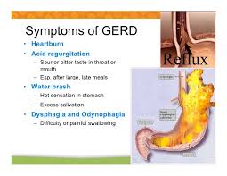 Pin On Gerd