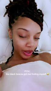 Embracing my New Look with Black Braces 😂😂