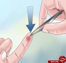 Maybe you would like to learn more about one of these? Ø±ÙˆØ´ÛŒ Ø³Ø§Ø¯Ù‡ Ø¨Ø±Ø§ÛŒ Ø®Ø§Ø±Ø¬ Ú©Ø±Ø¯Ù† ØªØ±Ø§Ø´Ù‡ Ù‡Ø§ÛŒ ÙØ±Ùˆ Ø±ÙØªÙ‡ Ø¯Ø± Ù¾ÙˆØ³Øª Ú©Ù‡ Ø­ØªÛŒ ÙÚ©Ø±Ø´ Ø±Ø§ Ù‡Ù… Ù†Ù…ÛŒ Ú©Ù†ÛŒØ¯