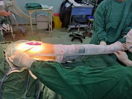 Image result for Shuck Test