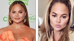 Sandra Lena Silverman 'asla yapılmaması gereken estetiği' açıkladı