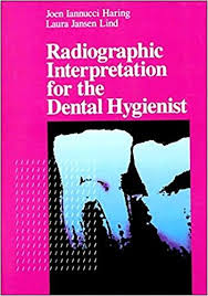 Download Pdf Radiographic Interpretation For The Dental Hygienist Free Epub Mobi Ebooks Dental Hygienist Hygienist College Textbook