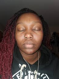 What are some effective skin care tips and products for acne?