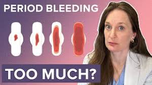 Image result for Menstrual Bleeding