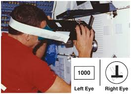 Image result for Oculovestibular Testing