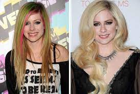 Со временем шумиха утихла, и о существовании аврил лавин некоторые и вовсе забыли. Avril Lavin Do I Posle Plastiki 300 Ekspertov Ru