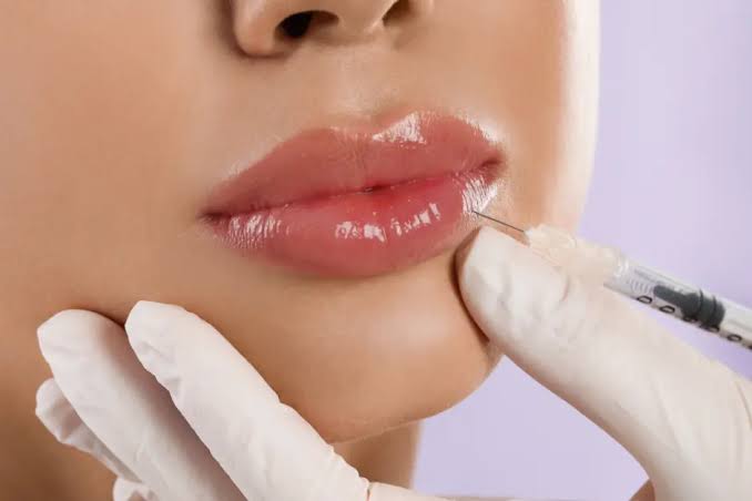 Lip Fillers Dubai | New Al Shefa Clinic JLT