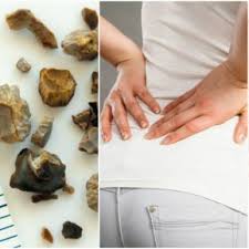 La începutul bolii, pacientul simte simptome de stare generală de rău, slăbiciune minoră, umflare a feței dimineața, este posibil să se formeze cercuri întunecate sub ochi. Durere De Rinichi Divahair Ro