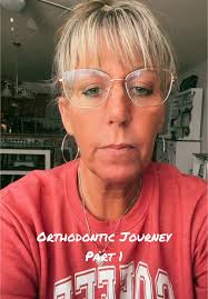 #adultorthodontics #fyp #sharemyjourney #orthodontics