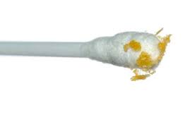 I dagligtale blir akutt rhinitt kalt forkjølelse. Tette Orer Kjerringrad