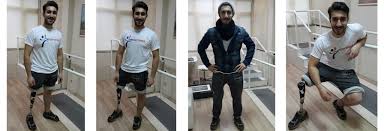 Ten Ortopedi Protez Ortez Kisiye Ozel Tabanlik Skolyoz Korse Ayakta Durma Sehpalari