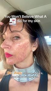 Joey Muller's Instagram, Twitter & Facebook