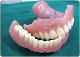 From your denture, goo gone, a denture brush, cotton swabs for the hard to reach nooks and crannies, and gloves to protect your hands from the skin drying action of the safe orange solvent. What Are Dentures
