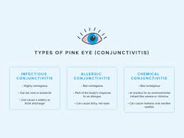 Image result for Viral Conjunctivitis