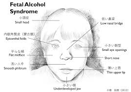 36 199 tykkäystä · 27 puhuu tästä. å¥³æ€§ã¨ã‚¢ãƒ«ã‚³ãƒ¼ãƒ«ã«ã¤ã„ã¦ ä¾å­˜ç—‡å¯¾ç­–å…¨å›½ã‚»ãƒ³ã‚¿ãƒ¼