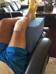 What to expect after arthroscopic knee surgery symptomfind arthroscopic knee surgery knee replacement exercises knee surgery from www.pinterest.com. How To Sleep After Knee Replacement 6 Steps Sleeping Position