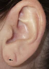 Child And Infant Ear Piercing Advice Elayne Angel S P