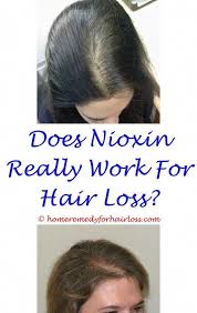 Reasons For Hair Loss In Young Females Can Metoprolol Tartrate Cause Hair Loss Anti Hair Loss Vitam Hair Loss Remedies Women Hair Loss Vitamins For Hair Loss